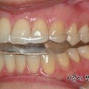 아트리움치과기공소 이미지