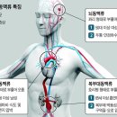 [정보] 뇌동맥류는 두통·복시, 복부는 박동성 혹 만져지면 의심 이미지