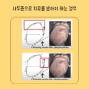 씨유좋은강안병원점 | 부산 좋은강안병원 아기 사두·단두·사경 진단 후기, 물리치료 시작