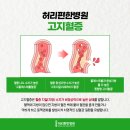 고지혈증의 이해와 관리 이미지