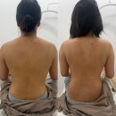 진영장등초등학교 | 진영 등 관리, 한 번으로도 라인이 달라집니다!-진영 피부관리실 다르 스킨케어