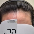 헤어라인