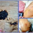 에덴복지요양센터 | ⭐ 에덴재가복지센터 – 최○○ 어르신 방문요양 사례 이야기