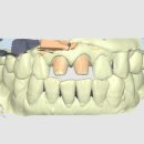 스마일치과기공소 이미지