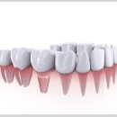 서울바른현치과의원 이미지