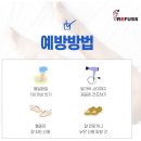 레푸스 사상점 이미지