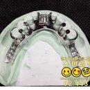 스마일기공소 이미지