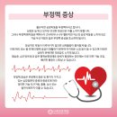 "부정맥 arrhythmia" 이미지