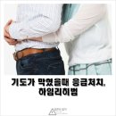 ★기도가 막혔을 때 응급조치 이미지