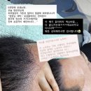 하얀헤어 - 서구 도솔4길 24 | 진주 두피문신 후기, 하얀 두피와 비어버린 헤어라인을 자연스럽게 채운 50대 남성 사례