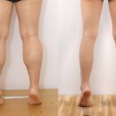 빅메디컬 | 2026 종아리 성형의 혁신: AI 빅데이터 알고리즘이 만드는 '초정밀' 각선미 (세이지의원)