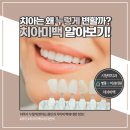 밝은수치과의원 이미지