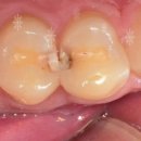 내곡웰치과의원 이미지