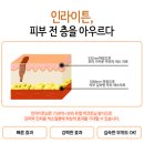 모반개발