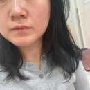 태화종합시장 고객지원센터 | 부산온열치료추천 부전동통증으로 도움된 기건강힐링센터 후기