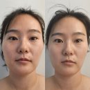 인계동 관리 추천 수바디디자인 소통테라피 케어 솔직후기