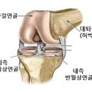 교통사고가 발생하여 후방십자인대 완전파열로﻿ 인대재건 수술을 한 경우 맥브라이드 동요장해를 받을 수 있습니까? 이미지