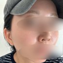 호승오일뱅크화장실 | 구로 피부관리 에스테틱 광인이 뽑은 1등샵 뷰티스킨케어 개봉동 등순환관리 후기