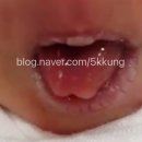 우주영상의학과의원 네이버블로그