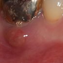 더바른윤치과의원 이미지