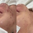 (주)제니스메디칼 | 에스테틱 올유어에스테틱 울산 남구 달동 가격위치주소이벤트할인 총정리