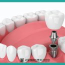 서울더안치과의원 이미지