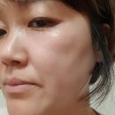 씨엔엠바이오 네이버블로그