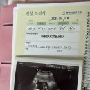 송해면보건지소 | 임신 34주차, 임당관리 효과봤나?🥹 드디어 정상범위 들어온 태아성장 | 임신일기 #26