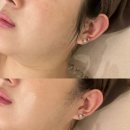 다산피부관리 [미올뷰티]리턴에이징 관리받고 감동 먹은 후기