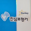 스타키보청기 이미지