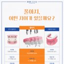 서울편한안치과의원 이미지