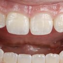 구미미르치과병원 이미지