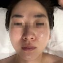 청담동에스테틱 김연옥에스테틱 sr테라피 윤곽관리 후기