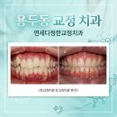 스마일라인치과교정과치과의원 | 용두동 교정 치과 선택 시 피해야 할 3가지