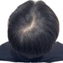 평소에 비어보이는 머리가 고민이라면? | 광주 상무지구 쌍촌동 뷰티인사이드 후기