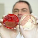 ﻿Killer E.coli strain described as deadliest yet 이미지