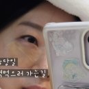 가나성형외과의원 | 광주 드림업 성형외과에서 눈밑지방재배치 수술 후기