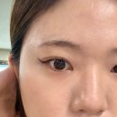 딥스트레칭엔케어 | 뷰니스 브이컷 딥 후기 아침 얼굴 붓기 때문에 고민이라면 한번쯤 챙겨볼 만했던 이유