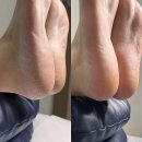 르베라천안점 | 피부관리 르베라 천안점 천안 서북구 백석동 가격위치주소이벤트할인 총정리