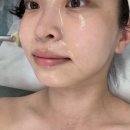 센텀해인요양병원 | 민락동피부관리 | 센텀웨딩관리로 유명하고 효과 좋은 온후에 예신관리 온후에젝션 후기
