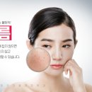 더블유피부과 이미지