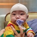 성동재활의원 | 단두와 사두가 같이있는 복합두상/ 오쏘코리아 두상교정모 6개월~16개월사용 총 10개월 동안 최종 찐 후기