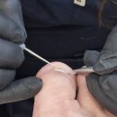 오로제주 | 제주문제성발관리] 남성 무좀발톱도 깔끔하게! 유벨리네일 오로지푸스 제주시청점 후기