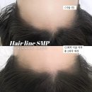 일산 두피 커버 smp 헤어라인 잘 하는 곳 오나뷰티 방문 후기 및 추천
