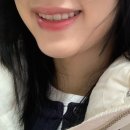 대구 무삭제 라미네이트 찐 후기 (미라클네이트)