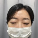 지성피부, 화농성 여드름, 모낭염 진정에 좋은 그린로그 징크스팟 앰플 솔직 후기