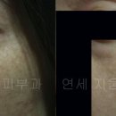 연세지움 Daum카페
