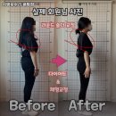 지방 부수리 이미지