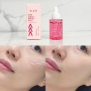 씨유후암좋아요점 | 바르는보톡스라길래 궁금해서 써본 티암 PDRN콜라겐세럼 후기