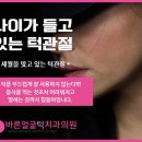 바른얼굴덕치과의원 네이버블로그